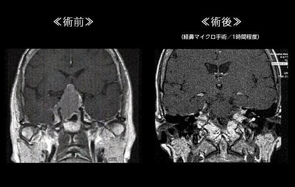 福島孝徳 脳神経外科 活動レポート 2019年5月09日～6月10日 | 脳神経