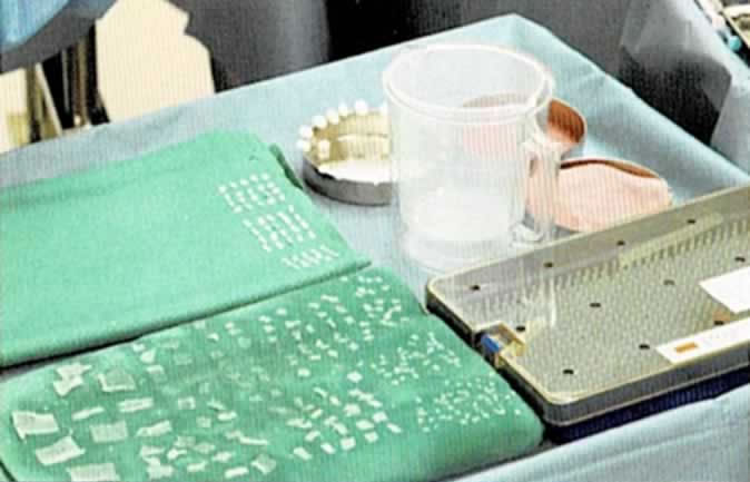 最先端の手術に不可欠な福島オリジナル手術器具 ※「神の手のミッション福島孝徳」 第3章【書籍抜粋】